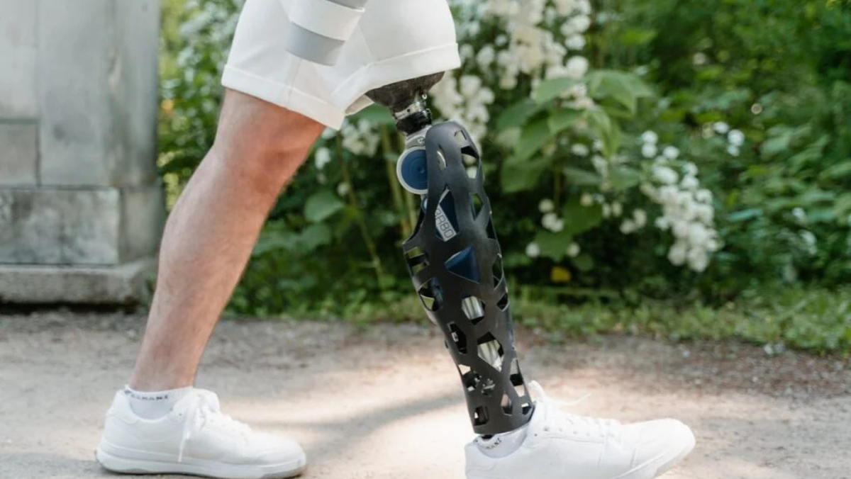Man walking outdoors with high-tech black prosthetic leg featuring open lattice design